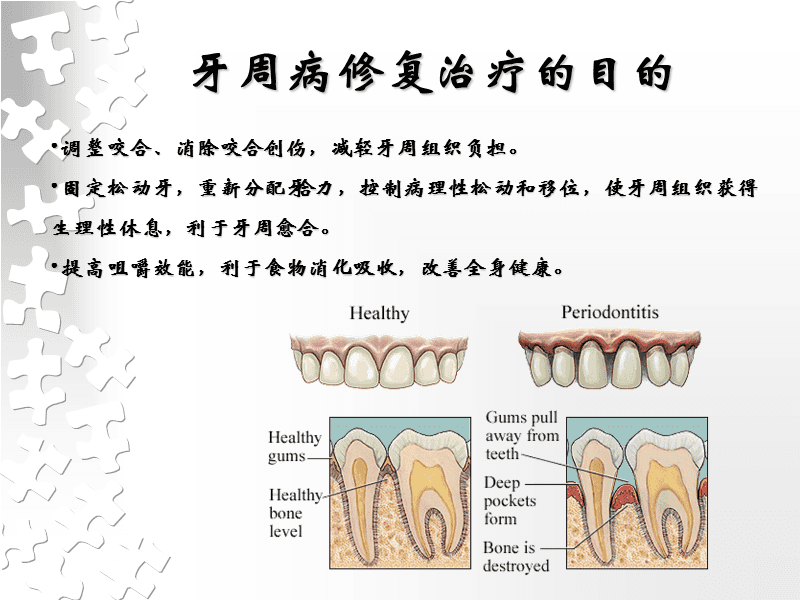 牙周病治疗